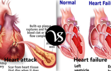 Difference between heart attack and heart failure